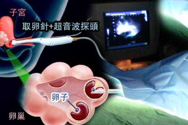 2023上海仁济医院可以做供卵试管婴儿吗?-代怀包性别中介